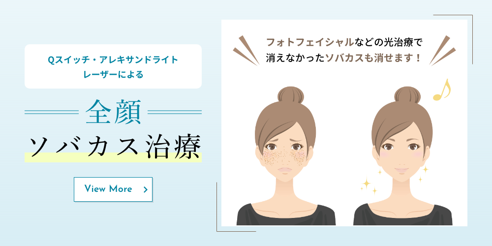 Qスイッチアレキサンドライトレーザーによる【全顔ソバカス治療】