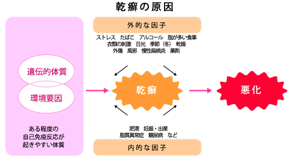 乾癬の原因