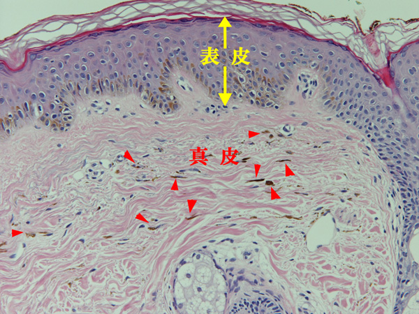 太田母斑の病理組織像