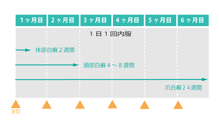 テルビナフィンによる内服治療